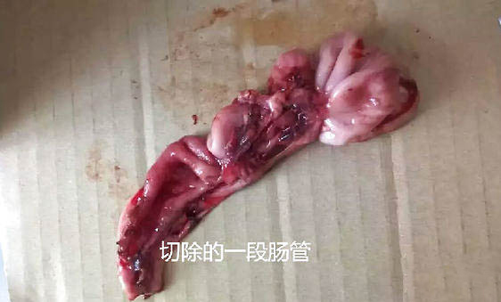 泰迪拉稀拉血是腸炎嗎
