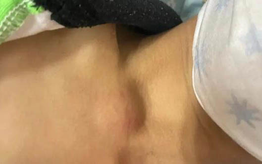狗狗吃撐了肚子特別大怎么辦